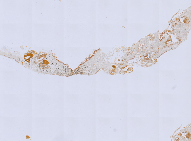 Mikroskopisches Bild einer formalin/PFA-fixierten Paraffin-embedded Gewebeschnitt, der mit anti-PFA1-Antikörper (EPR22828) und BSA gefärbt ist.